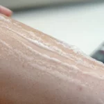 Dynamic Rapid Recovery - Image 3